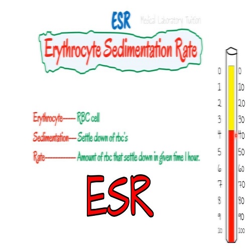 ERYTHROCYTE SEDIMENTATION RATE (ESR) 