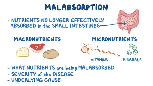 TYPES  OF  MAL  ABSORPTION,  CAUSES  OF  MAL  ABSORPTION,  SYMPTOMS  AS  WELL  AS  CLINICAL  MANIFESTATIONS  OF  MAL  ABSORPTION,  DIAGNOSIS  AS  WELL  AS  TREATMENT  OF  MAL  ABSORPTION